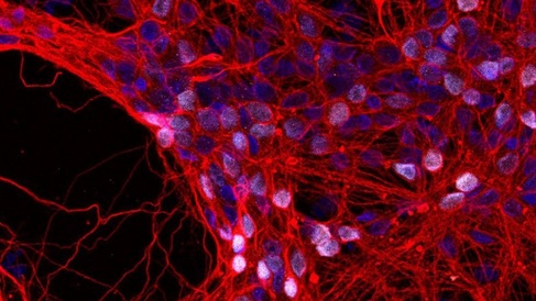 Photograph of neurones stained red and purple. 